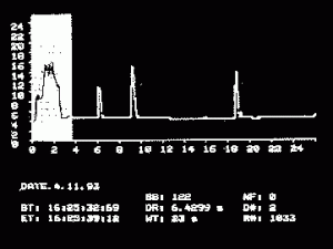 Apple IIe strip-chart display